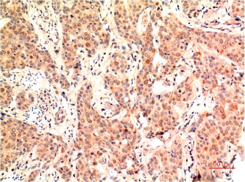 Anti-ERK1 (7E7) Mouse Monoclonal Antibody