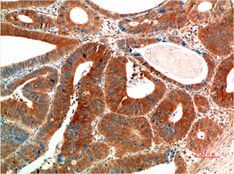 Anti-Phospho-ERK1/2 (Tyr222/Tyr205) (10C8) Mouse Monoclonal Antibody