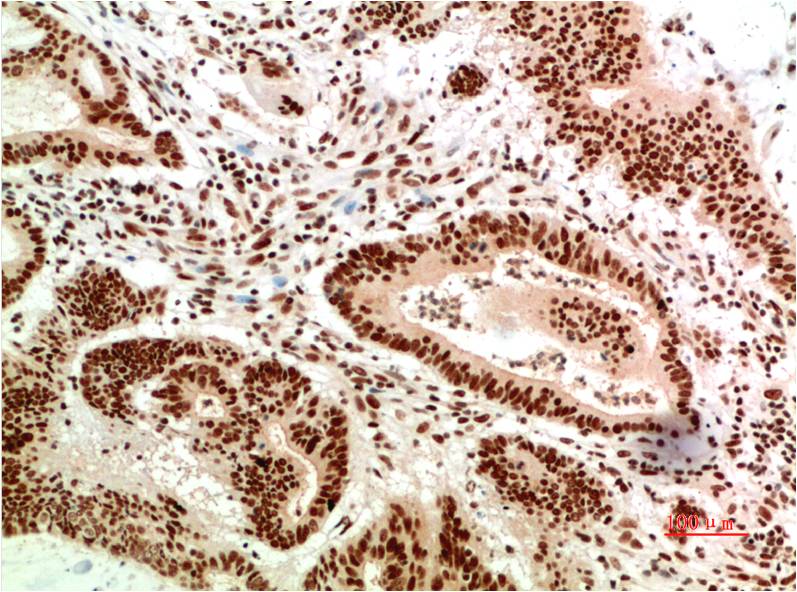 Anti-ATM (9F7) Mouse Monoclonal Antibody