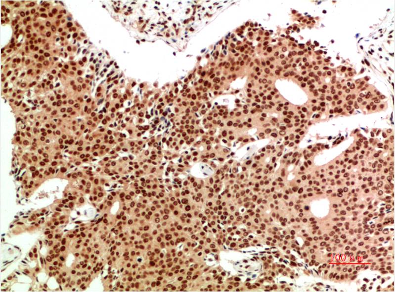 Anti-ATM (9F7) Mouse Monoclonal Antibody