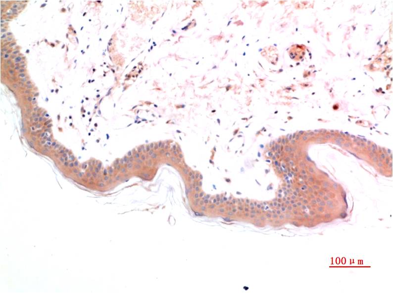 Anti-Phospho-Smad3 (Ser425) (7H6) Mouse Monoclonal Antibody