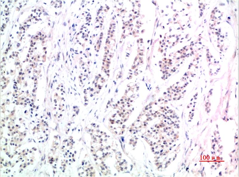 Anti-Phospho-Smad3 (Ser425) (7H6) Mouse Monoclonal Antibody