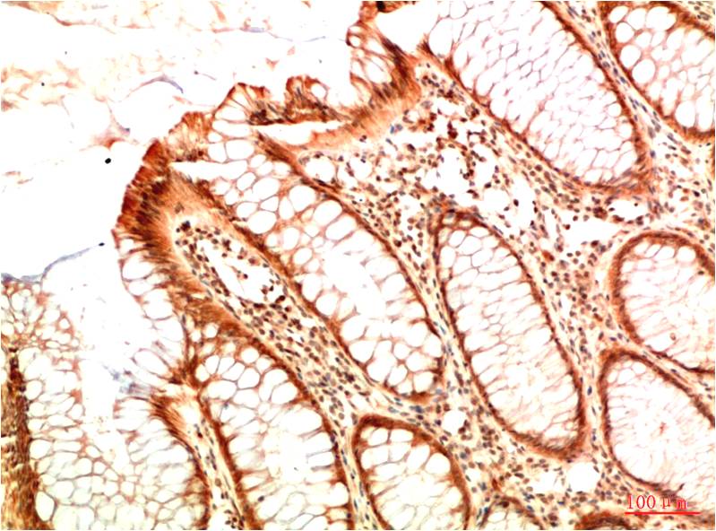 Anti-Acetyl-p53 (Lys382) (7E1) Mouse Monoclonal Antibody