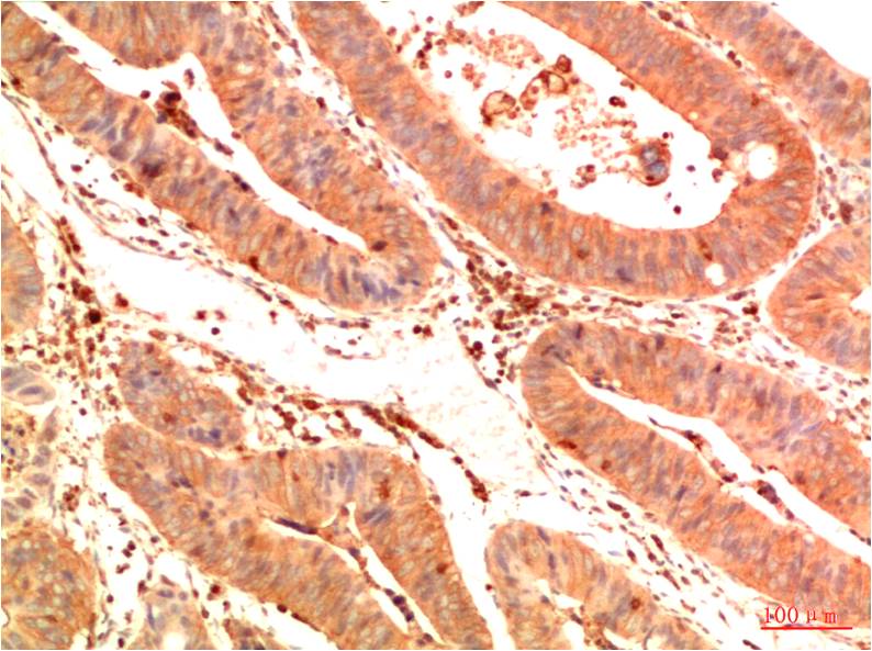 Anti-Acetyl-p53 (Lys382) (3E3) Mouse Monoclonal Antibody