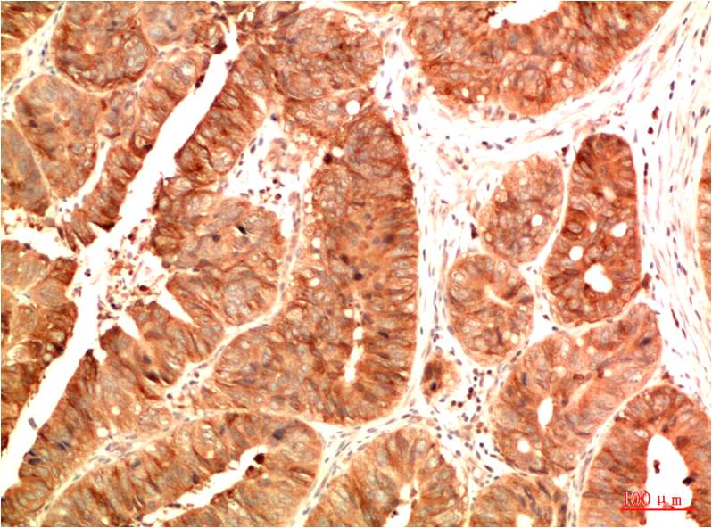 Anti-Acetyl-p53 (Lys382) (2G4) Mouse Monoclonal Antibody