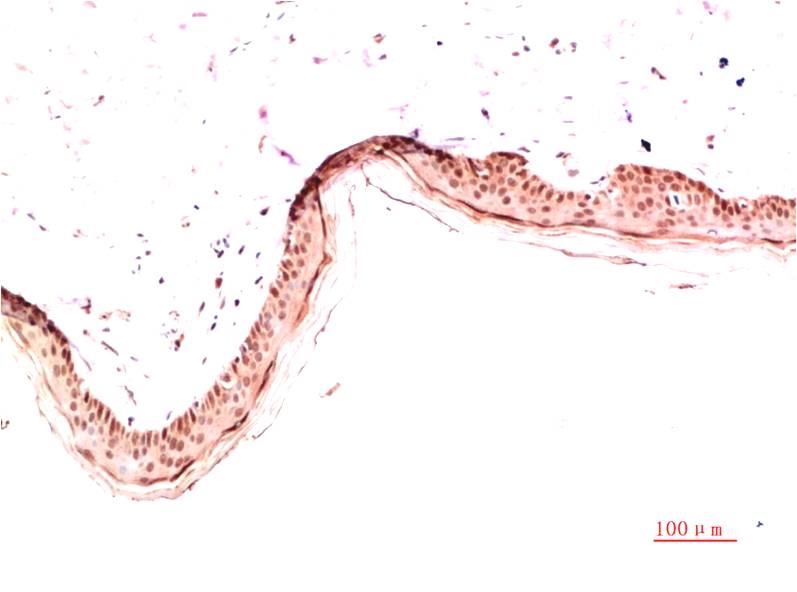 Anti-Collagen I alpha 1 (4C4) Mouse Monoclonal Antibody
