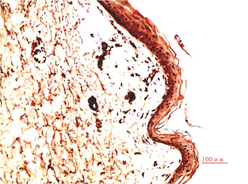 Anti-Collagen IV alpha 1 (2G3) Mouse Monoclonal Antibody