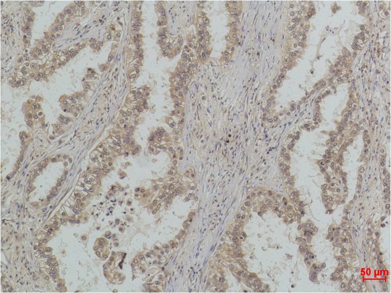 Anti-MonoMethyl-p53 (Lys370) (4C7) Mouse Monoclonal Antibody
