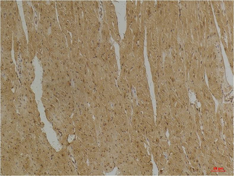 Anti-Desmin (4H1) Mouse Monoclonal Antibody