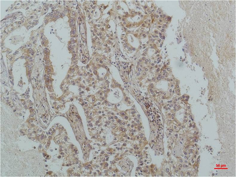 Anti-IKB beta (3H3) Mouse Monoclonal Antibody