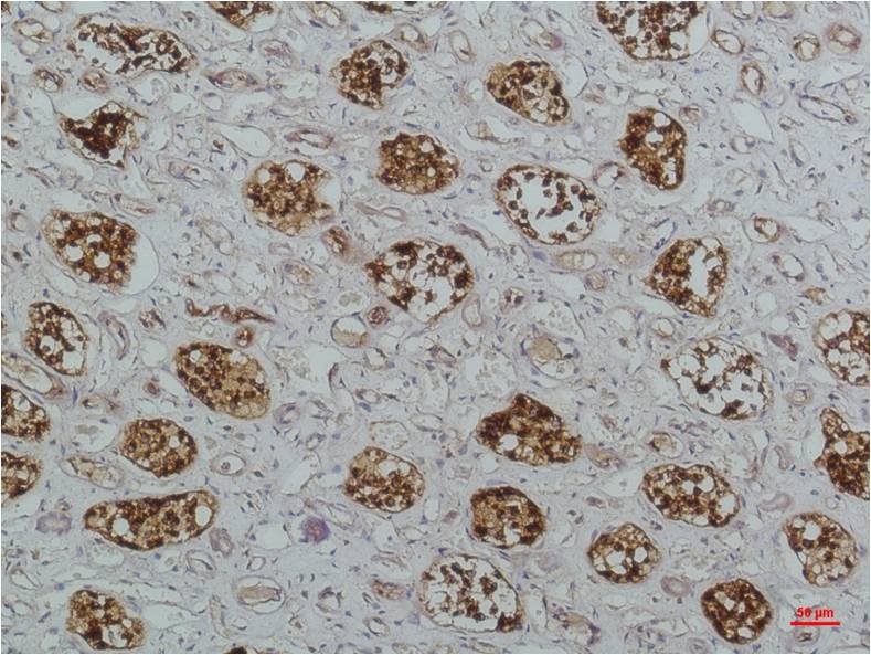 Anti-IKB beta (3H3) Mouse Monoclonal Antibody