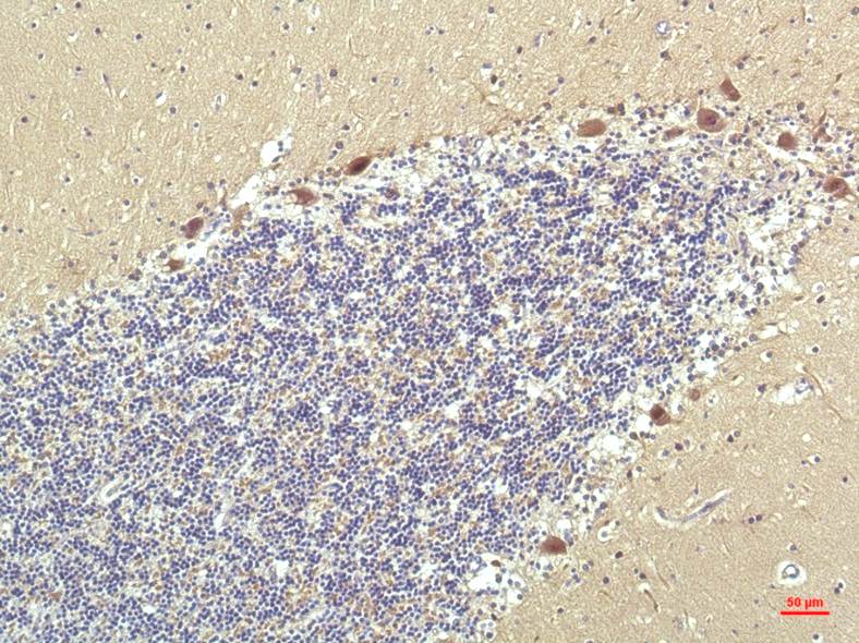 Anti-PPAR delta (4G5) Mouse Monoclonal Antibody