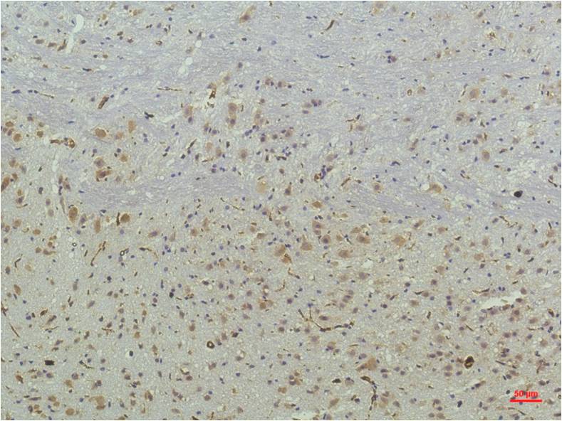Anti-PPAR delta (4G5) Mouse Monoclonal Antibody
