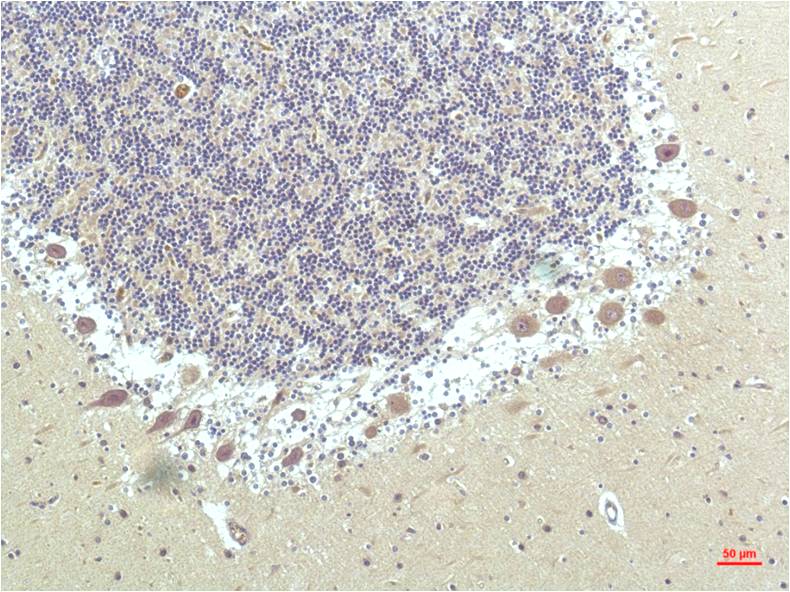 Anti-PPAR delta (4F4) Mouse Monoclonal Antibody