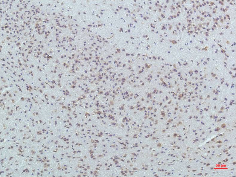 Anti-PPAR delta (4F4) Mouse Monoclonal Antibody