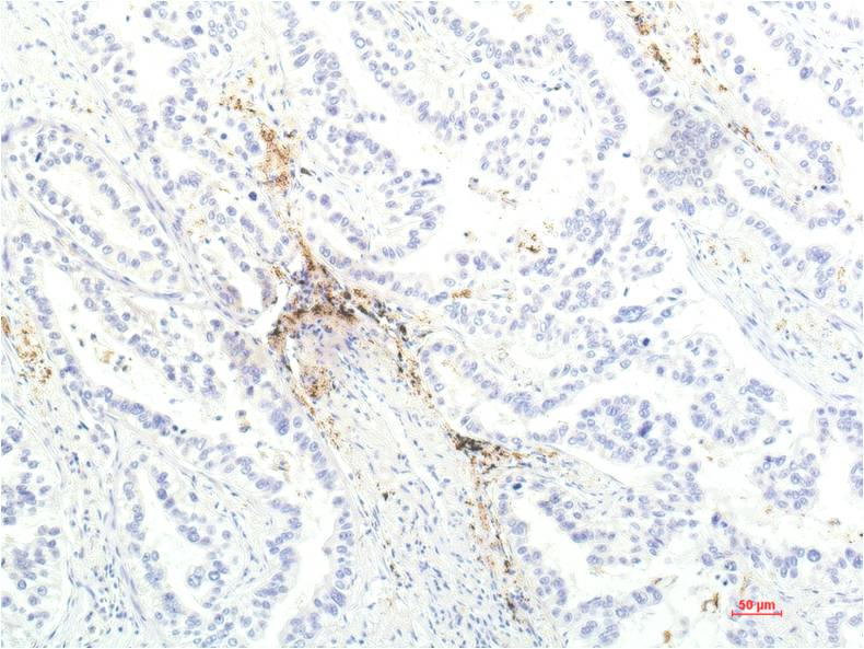 Anti-JAK1 (8D8) Mouse Monoclonal Antibody