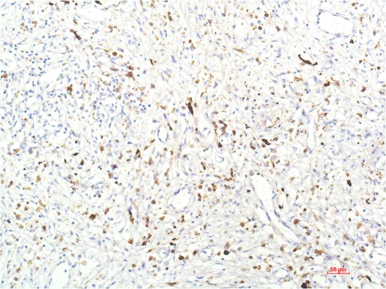 Anti-JAK1 (8D8) Mouse Monoclonal Antibody