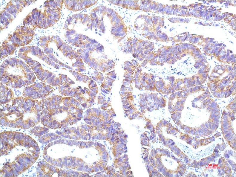Anti-STAT1 (9G8) Mouse Monoclonal Antibody