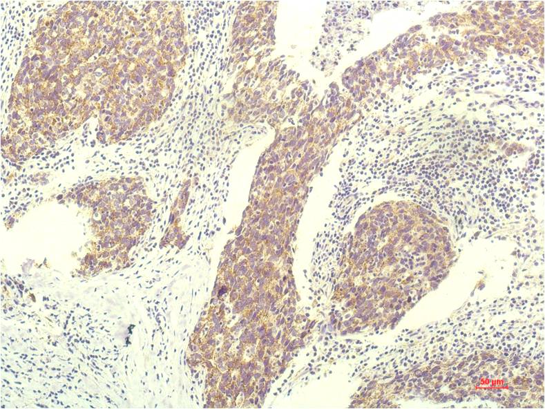 Anti-STAT1 (9G8) Mouse Monoclonal Antibody