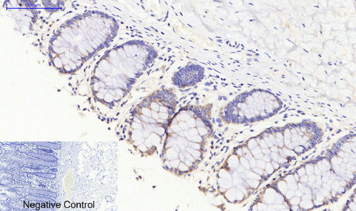 Anti-JAK3 Rabbit Polyclonal Antibody
