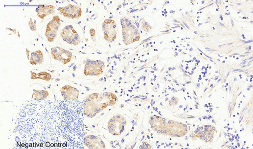 Anti-JAK3 Rabbit Polyclonal Antibody