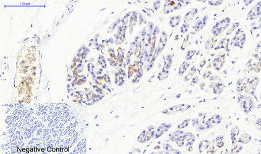 Anti-JAK3 Rabbit Polyclonal Antibody
