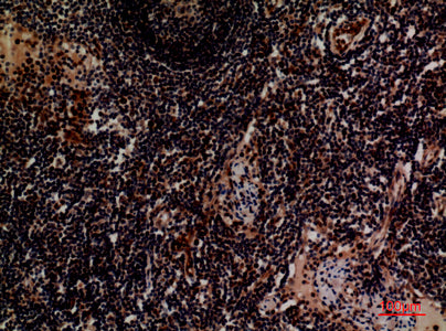 Anti-Integrin alpha 4 Rabbit Polyclonal Antibody