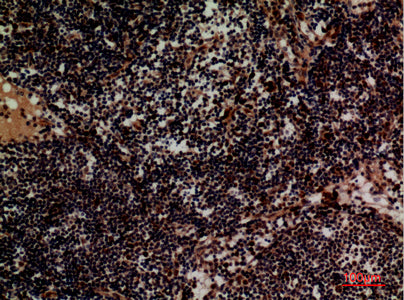 Anti-Integrin alpha 4 Rabbit Polyclonal Antibody