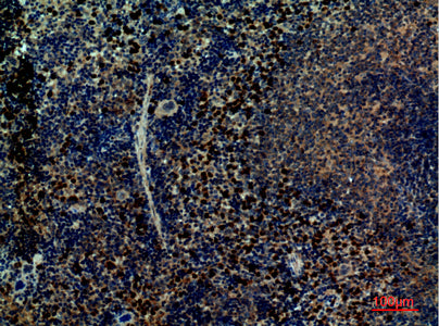 Anti-Integrin alpha 4 Rabbit Polyclonal Antibody