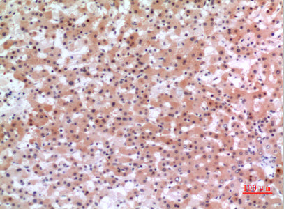 Anti-Inhibin beta E Rabbit Polyclonal Antibody