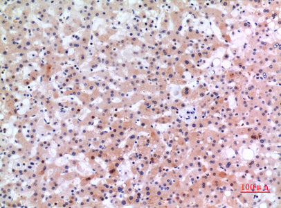 Anti-Inhibin beta E Rabbit Polyclonal Antibody