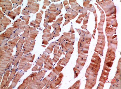 Anti-Inhibin beta E Rabbit Polyclonal Antibody