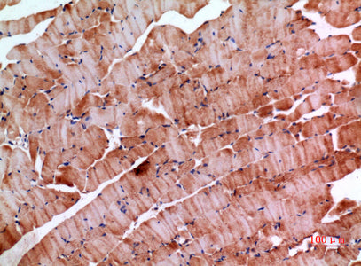 Anti-Inhibin beta E Rabbit Polyclonal Antibody