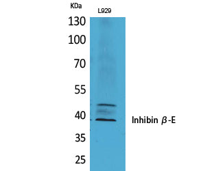Anti-Inhibin beta E Rabbit Polyclonal Antibody