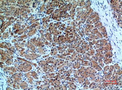 Anti-CXCR6 Rabbit Polyclonal Antibody
