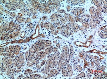 Anti-CXCR6 Rabbit Polyclonal Antibody