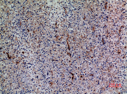 Anti-CXCR6 Rabbit Polyclonal Antibody