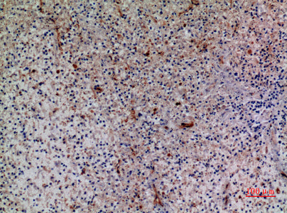 Anti-CXCR6 Rabbit Polyclonal Antibody