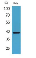 Anti-CXCR6 Rabbit Polyclonal Antibody