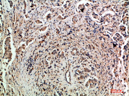 Anti-TLE1/2/3/4 Rabbit Polyclonal Antibody