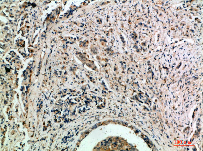 Anti-TLE1/2/3/4 Rabbit Polyclonal Antibody