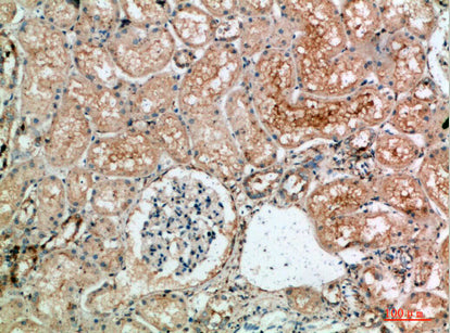 Anti-TLE1/2/3/4 Rabbit Polyclonal Antibody