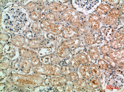 Anti-TLE1/2/3/4 Rabbit Polyclonal Antibody