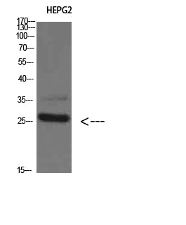 Anti-Tryptase delta Rabbit Polyclonal Antibody
