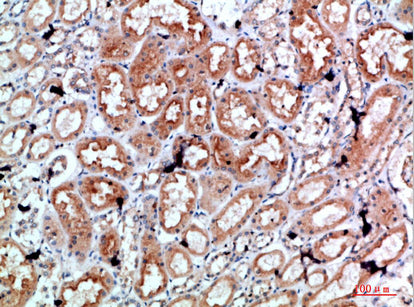 Anti-Perforin Rabbit Polyclonal Antibody