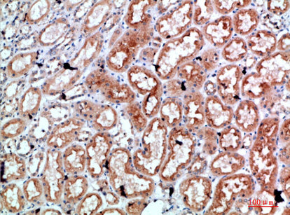 Anti-Perforin Rabbit Polyclonal Antibody