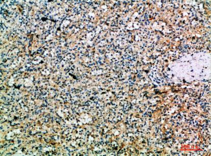 Anti-Perforin Rabbit Polyclonal Antibody