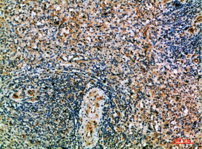 Anti-Perforin Rabbit Polyclonal Antibody