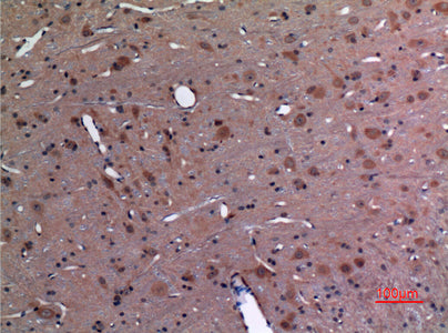 Anti-Ubiquitin Conjugating Enzyme E2 A/B Rabbit Polyclonal Antibody