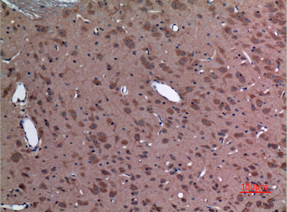 Anti-Ubiquitin Conjugating Enzyme E2 A/B Rabbit Polyclonal Antibody